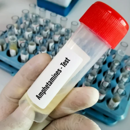 Pemeriksaan Amphetamin ( Screening Test ) di Amalia Medical Center