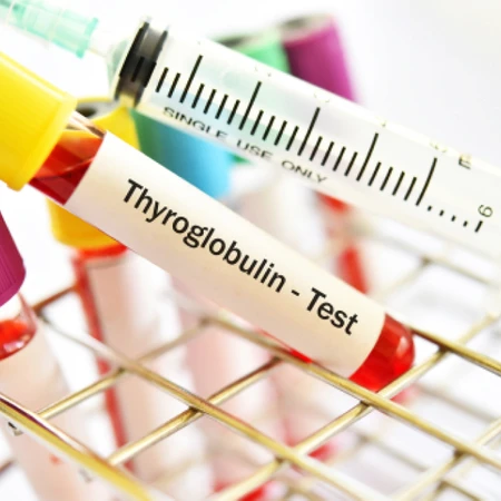 Pemeriksaan Anti Tyroglobulin di Amalia Medical Center