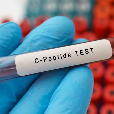 Pemeriksaan Diabetes (C-Peptide) di Amalia Medical Center