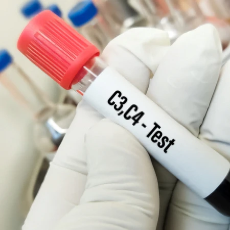 Pemeriksaan C3 Complemen di Amalia Medical Center