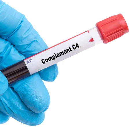 Pemeriksaan C4 Complement di Amalia Medical Center