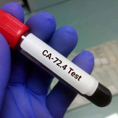 Pemeriksaan Kanker (Ca 72-4) di Amalia Medical Center