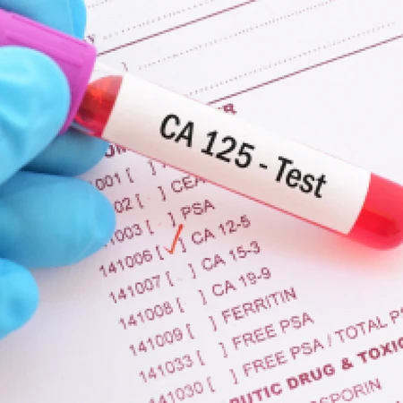 Pemeriksaan Kanker (CA-125) di Amalia Medical Center