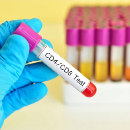 Pemeriksaan CD 4 - CD 8 di Amalia Medical Center