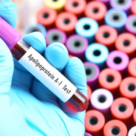 Pemeriksaan Chol Apo A-1 di Amalia Medical Center