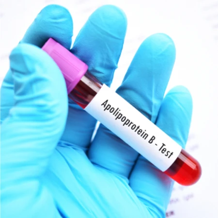 Pemeriksaan Chol Apo B di Amalia Medical Center