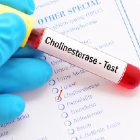 Pemeriksaan Hati (Cholinesterase) di Amalia Medical Center