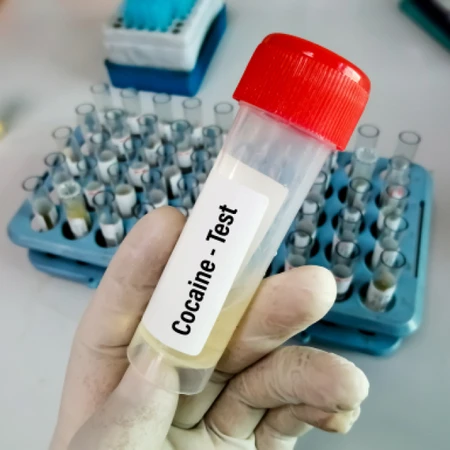 Pemeriksaan Cocaine ( Screening Test ) di Amalia Medical Center