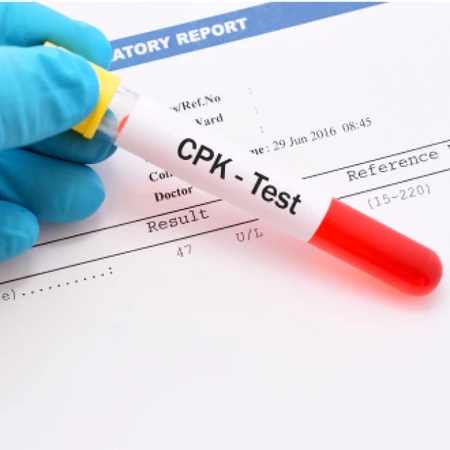 Pemeriksaan CPK / CK di Amalia Medical Center