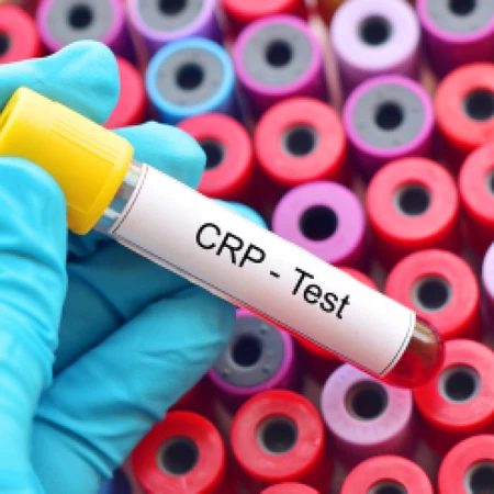 Pemeriksaan CRP Kualitatif di Amalia Medical Center