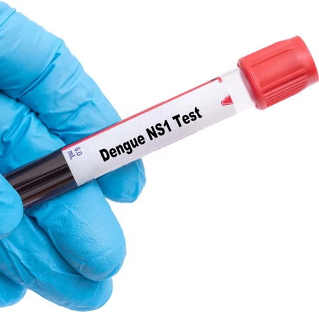 Pemeriksaan Dengue NS1 (rapid) di Amalia Medical Center