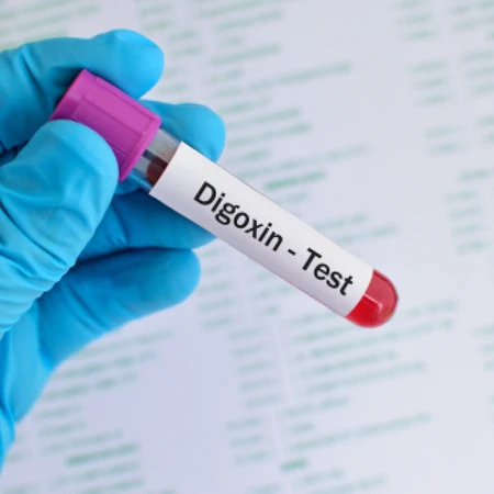 Pemeriksaan Digoxin di Amalia Medical Center