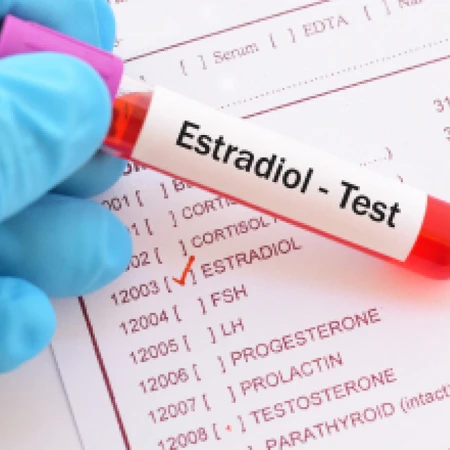 Pemeriksaan Estradiol di Amalia Medical Center