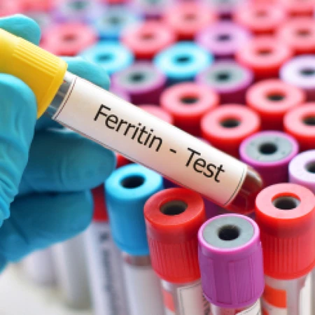 Pemeriksaan Ferritin di Amalia Medical Center