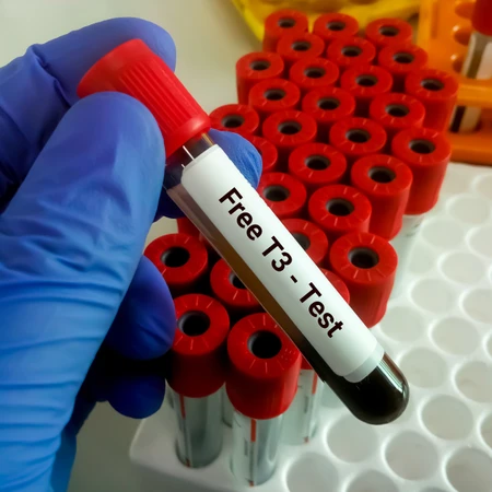 Pemeriksaan Free T3 di Amalia Medical Center