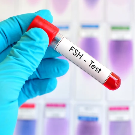 Pemeriksaan FSH di Amalia Medical Center