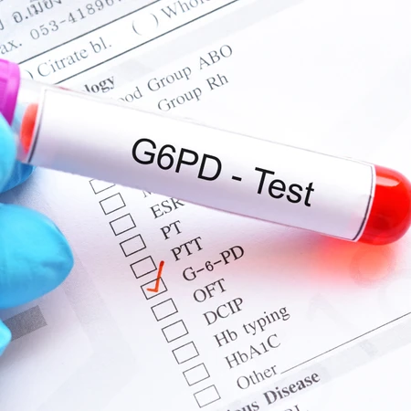 Pemeriksaan G 6 PD di Amalia Medical Center