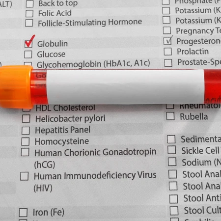 Pemeriksaan Hati (Gamma Globulin) di Amalia Medical Center