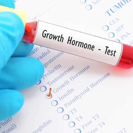 Cek Hormon Growth Basal di Amalia Medical Center