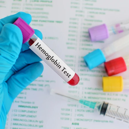 Pemeriksaan Hemoglobin di Amalia Medical Center