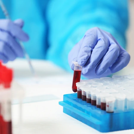 Pemeriksaan Hitung Jenis di Amalia Medical Center