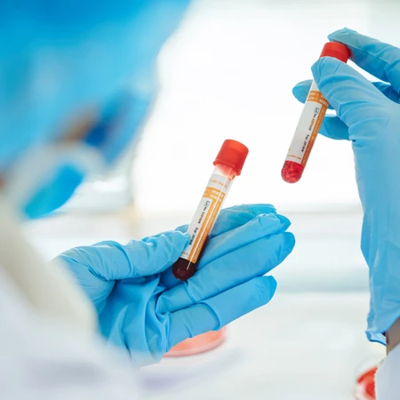 Pemeriksaan Diabetes (Homa 1-1R, Homa 1-1%B) di Amalia Medical Center