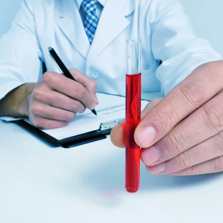 Pemeriksaan Kanker (HTLV-I/II) di Amalia Medical Center