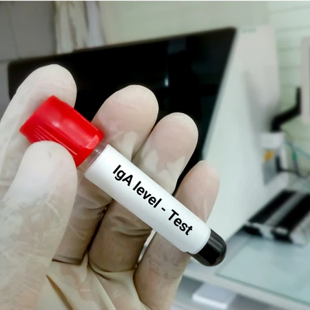 Pemeriksaan IgA di Amalia Medical Center