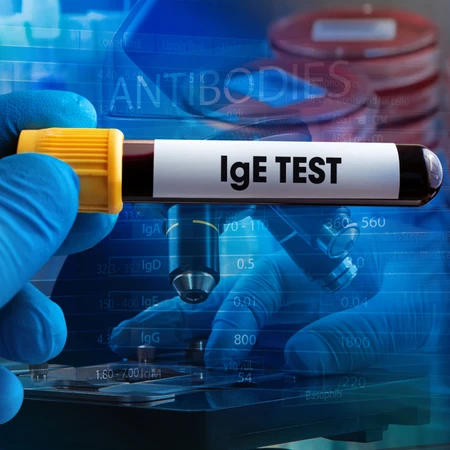 Pemeriksaan IgE Total di Amalia Medical Center