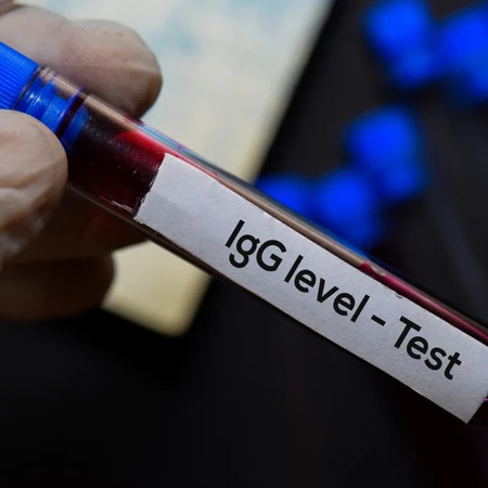 Pemeriksaan IgG Anti DHF di Amalia Medical Center