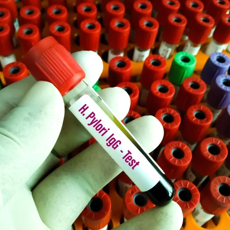 Pemeriksaan Lambung (IgG Helicobacter Pylori) di Amalia Medical Center