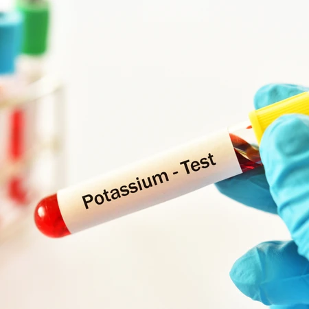 Pemeriksaan Kalium di Amalia Medical Center