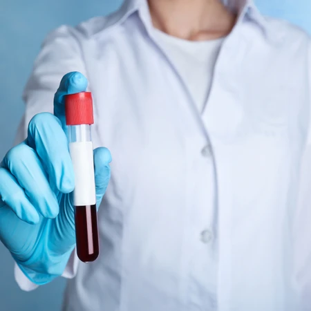 Pemeriksaan Kultur Darah di Amalia Medical Center