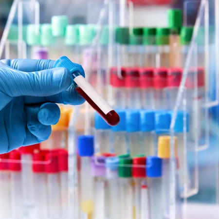 Pemeriksaan Kultur Darah ( Vitek Methode ) di Amalia Medical Center