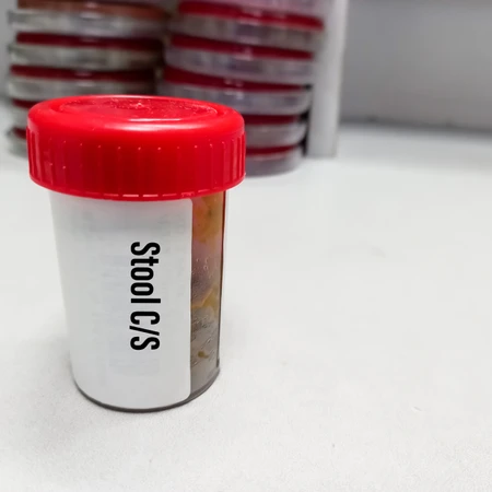 Pemeriksaan Kultur Faeces di Amalia Medical Center