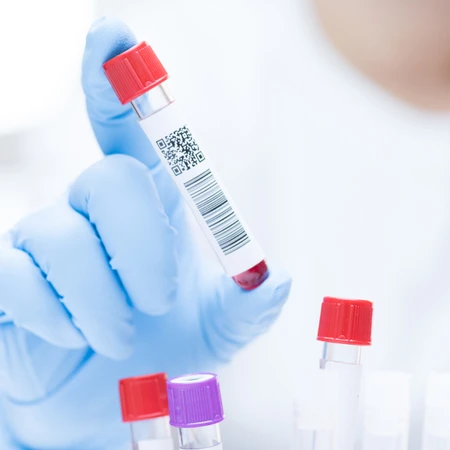 Pemeriksaan Laju Endap Darah ( LED ) di Amalia Medical Center