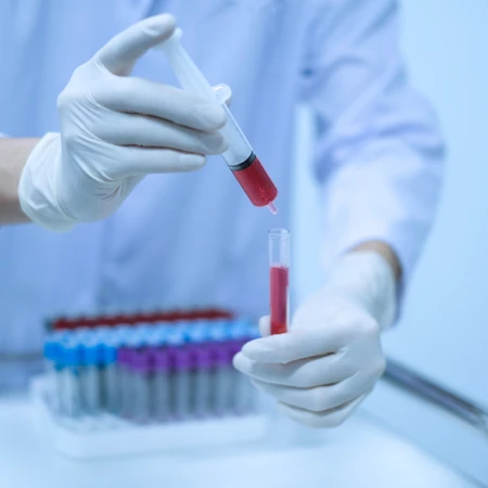 Pemeriksaan Leukosit di Amalia Medical Center