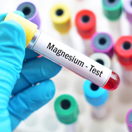 Pemeriksaan Magnesium di Amalia Medical Center