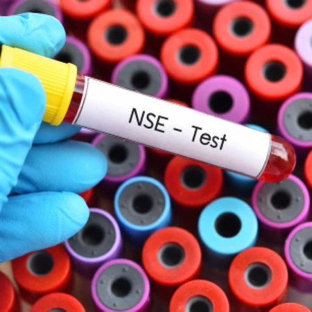 Pemeriksaan Paru-paru (NSE) di Amalia Medical Center