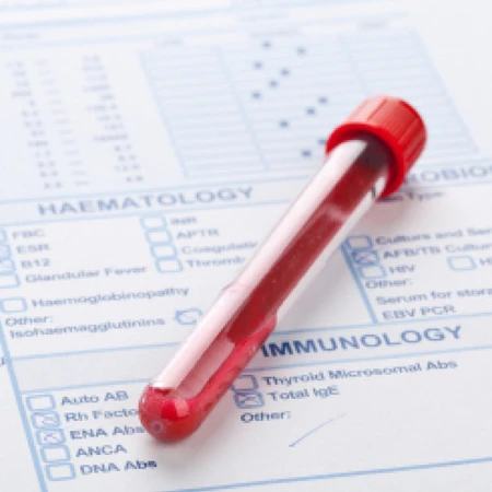 Pemeriksaan Occult Blood Test di Amalia Medical Center