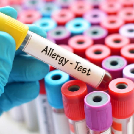 Pemeriksaan Panel IgE Spesifik (52 Jenis) di Amalia Medical Center