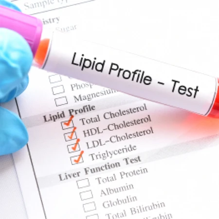 Pemeriksaan Panel Profil Lemak Kolesterol di Amalia Medical Center