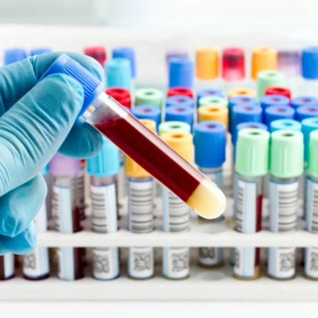 Pemeriksaan Phenytoin/Dilantin di Amalia Medical Center