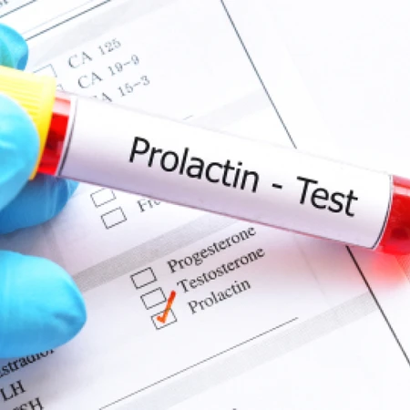 Pemeriksaan Prolaktin (Hormon Menyusui) di Amalia Medical Center