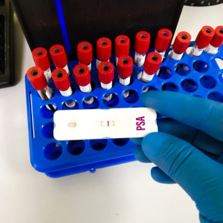 Pemeriksaan PSA Total di Amalia Medical Center