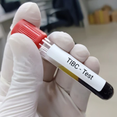 Pemeriksaan TIBC di Amalia Medical Center