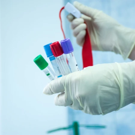 Pemeriksaan Kolesterol (Total Lipid) di Amalia Medical Center