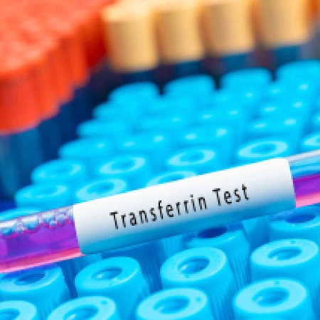 Pemeriksaan Transferin di Amalia Medical Center