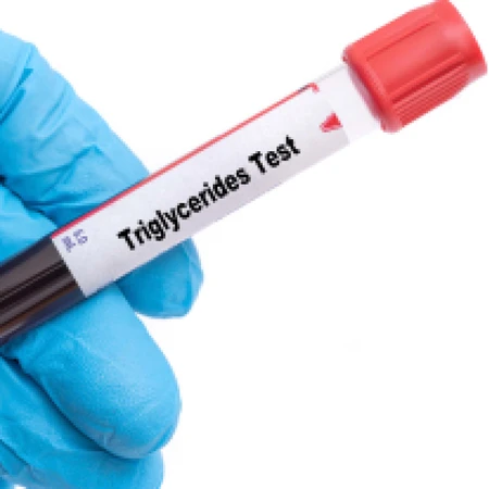 Pemeriksaan Trigliserida di Amalia Medical Center