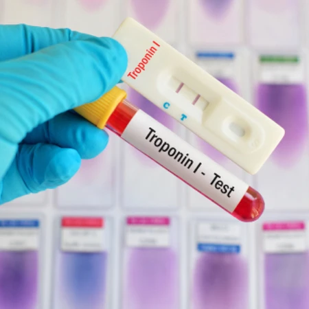 Pemeriksaan Troponin I di Amalia Medical Center